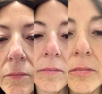 Purevlab BP Spicule Plumping Lip Shot